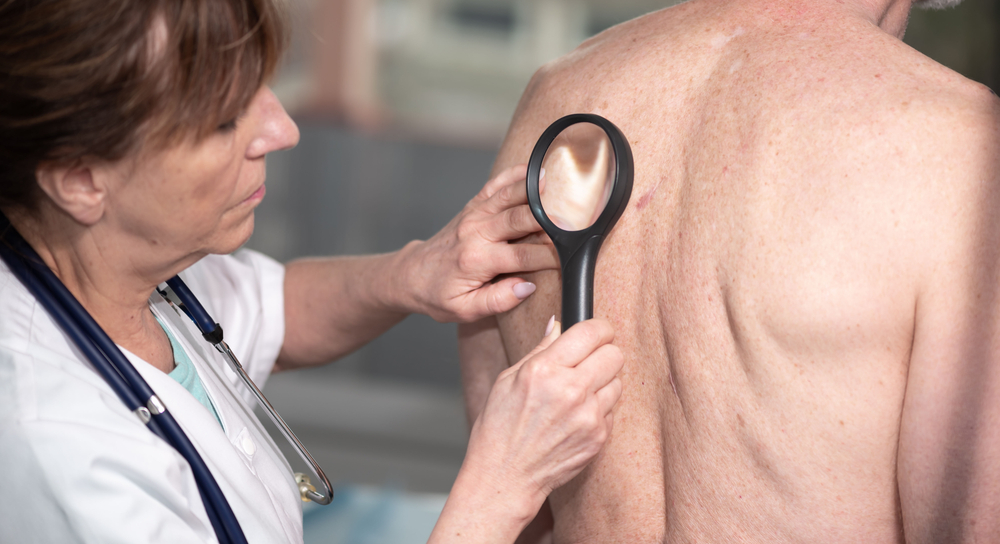 cannabis na dermatologia