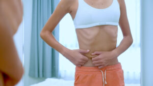 cannabis e anorexia