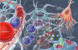 Neuroinflamação crônica e prolongada pode culminar em neurodegeneração e morte neuronal. Fonte: MONTAGNER, Patrícia; DE SALAS-QUIROGA, Adán. Tratado de Medicina Endocanabinoide.1. ed. WeCann Endocannabinoid Global Academy, 2023.