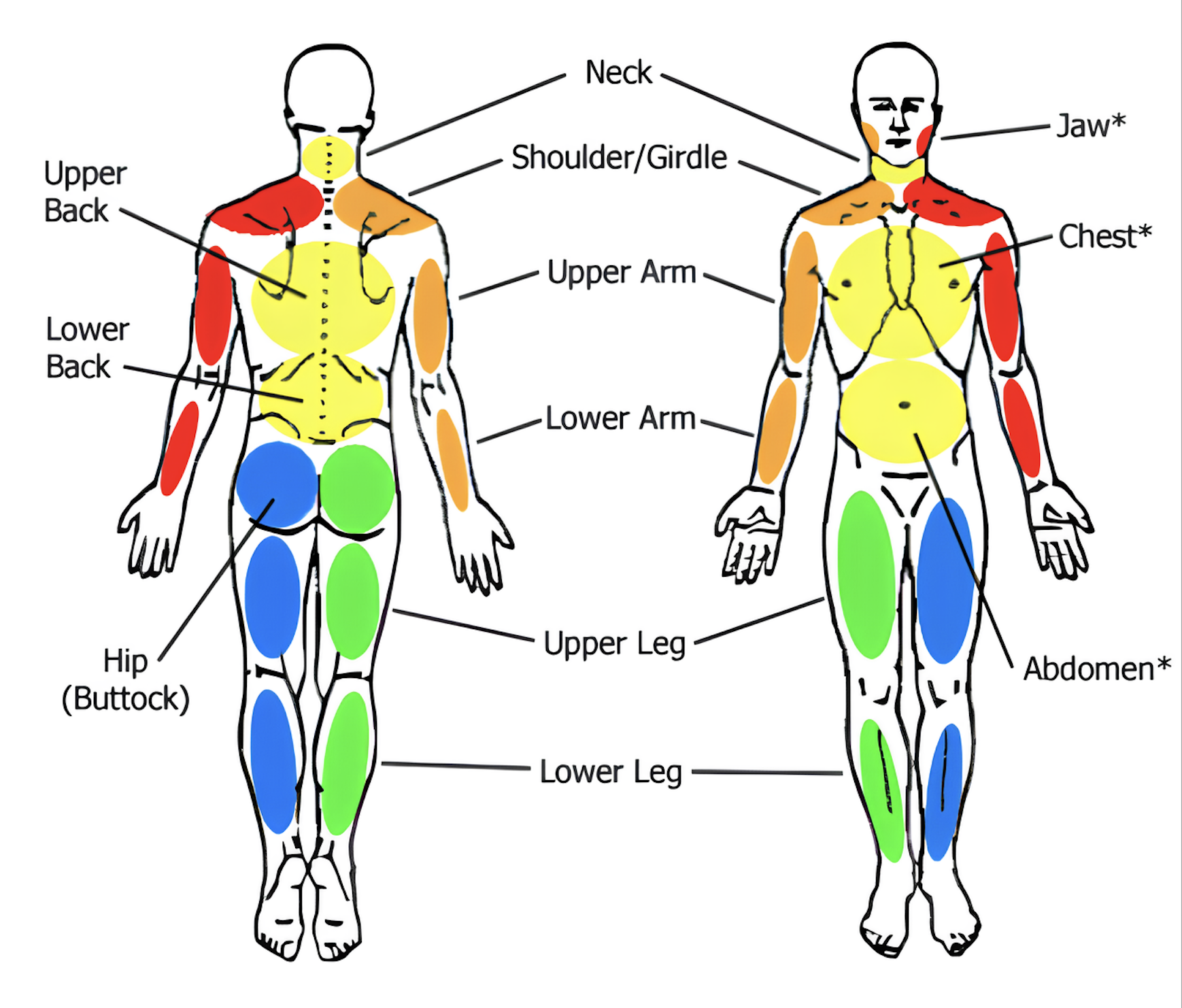 Diagrama das regiões avaliadas pelo Índice de Dor Generalizada (WPI) no diagnóstico da fibromialgia. As áreas estão divididas em cinco regiões: superior esquerda (mandíbula, cintura escapular, braço, antebraço), superior direita (mandíbula, cintura escapular, braço, antebraço), inferior esquerda (quadril/nádega, coxa, perna), inferior direita (quadril/nádega, coxa, perna) e axial ou central (pescoço, parte superior e inferior das costas, tórax, abdômen). A dor deve estar presente em pelo menos quatro dessas regiões para atender aos critérios diagnósticos. Fonte: Wolfe, F., Clauw, D. J., Fitzcharles, M. A., Goldenberg, D. L., Häuser, W., Katz, R. L., Mease, P. J., Russell, A. S., Russell, I. J., Walitt, B. "2016 Revisions to the 2010/2011 Fibromyalgia Diagnostic Criteria," Seminars in Arthritis and Rheumatism, vol. 46, no. 3, pp. 319-329, 2016.