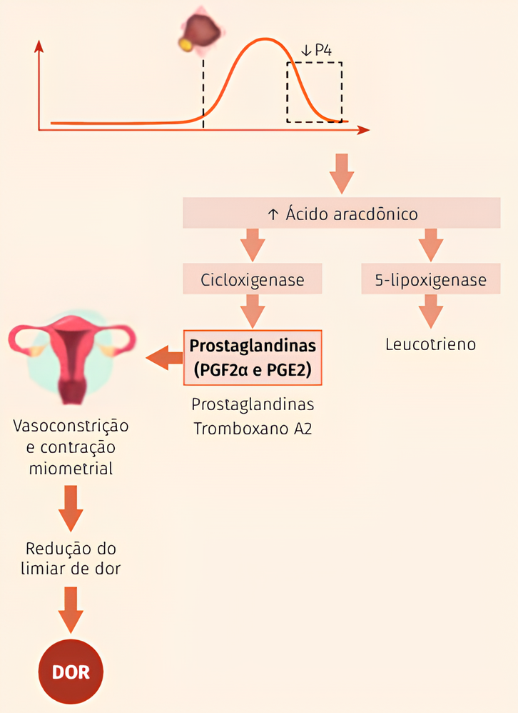 Fisiopatologia da dismenorreia primária. Fonte: TRONCON, Júlia Kefalás; ROSA-E-SILVA, Ana Carolina Japur de Sá; REIS, Rosana Maria dos. Dismenorreia: abordagem diagnóstica e terapêutica. Publicação Oficial da Federação Brasileira das Associações de Ginecologia e Obstetrícia, v. 48, n. 9, 2020.
